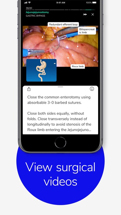 Touch Surgery: Surgical Videos screenshot-5