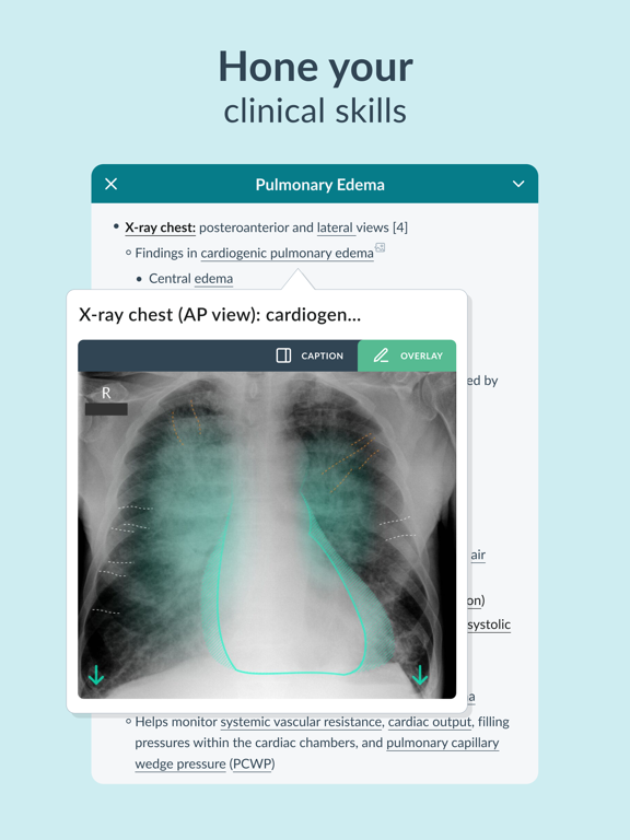 Screenshot #6 pour AMBOSS Medical Knowledge