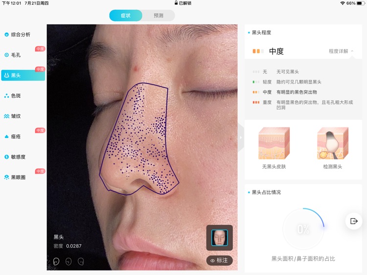智慧美肌 screenshot-5