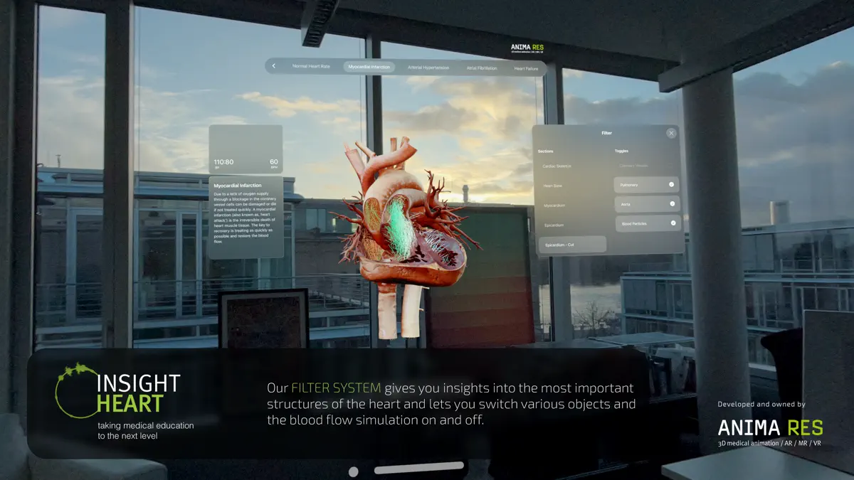 INSIGHT HEART screenshot 9