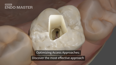 Dental EndoMaster Screenshot