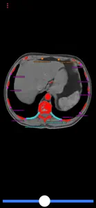 Biopsy Guide screenshot #2 for iPhone