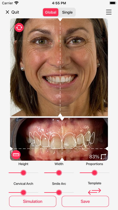 Hybridge Smile Design Screenshot