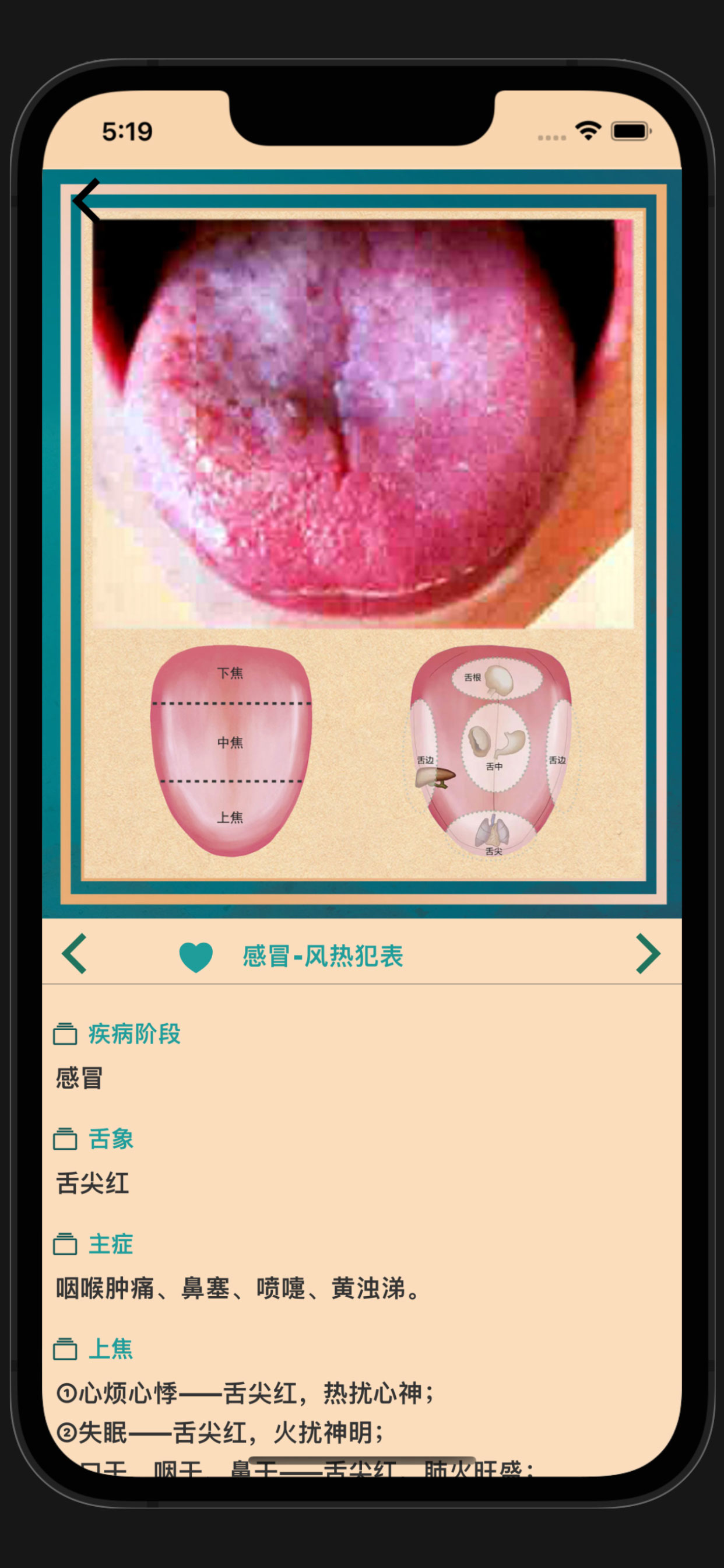 中医舌诊宝典