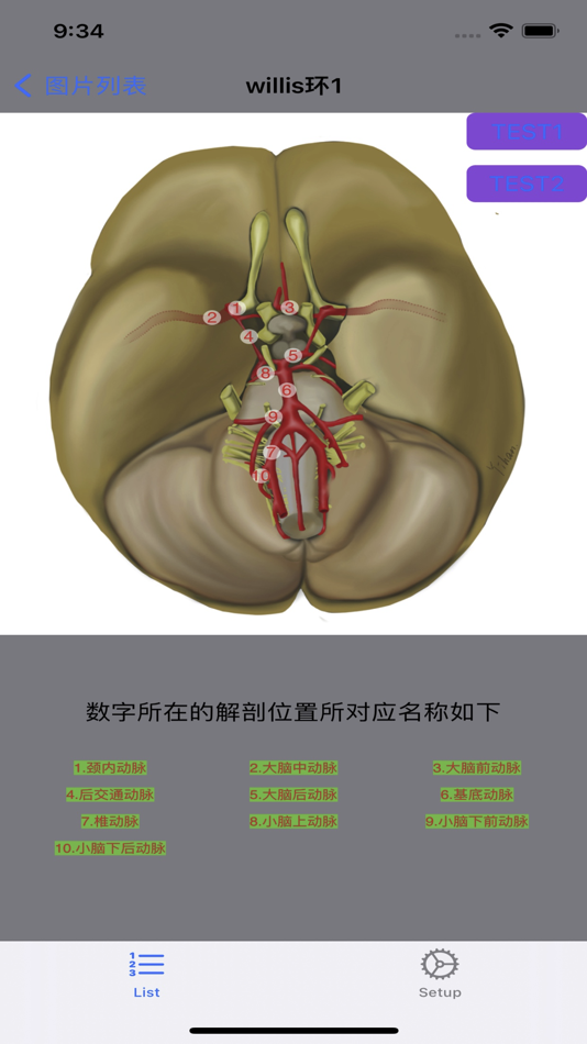 #2. 脑血管学习 (iOS) 게시자: 艺 张