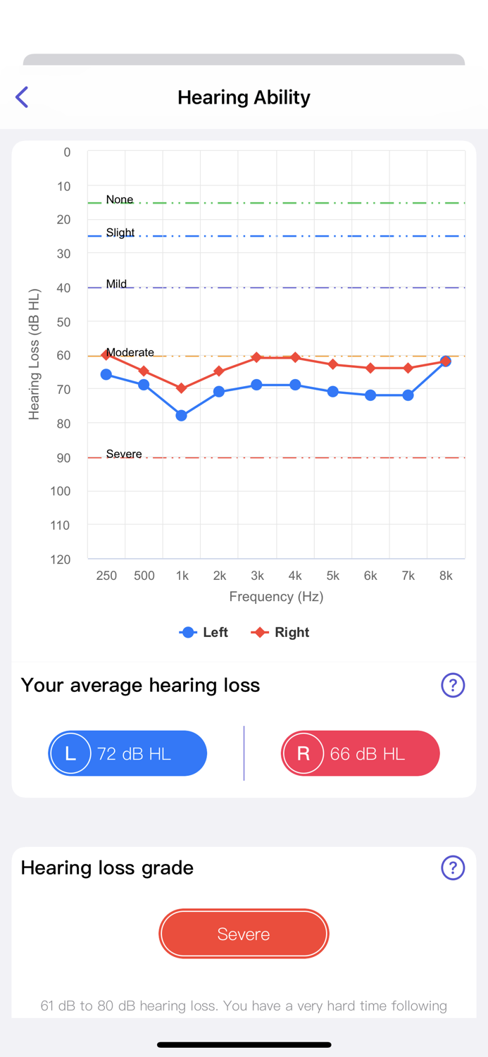 xHearing