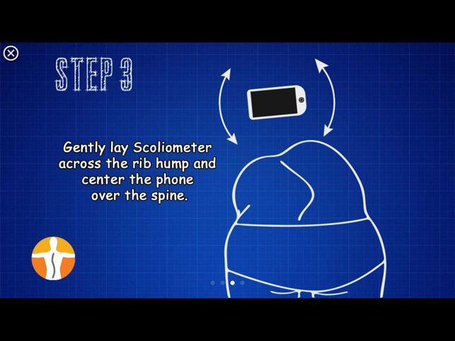 Screenshot van de scoliometer
