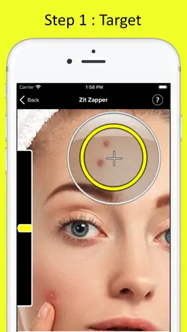 Game screenshot Zit Zapper - Remove Pimples apk