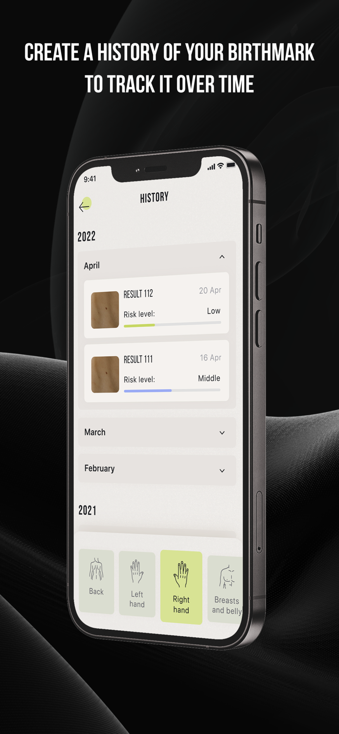 CUBE-Check Ur Birthmark Easily