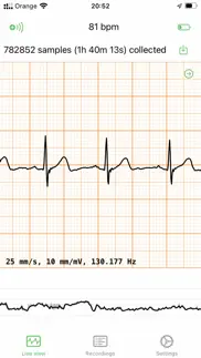 How to cancel & delete ecg ekg viewer for polar h10 2