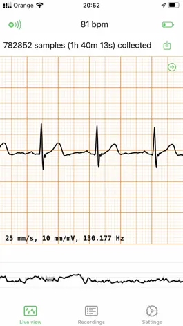 Game screenshot ECG EKG Viewer for Polar H10 mod apk