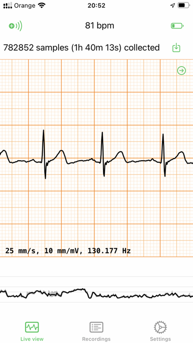 Screenshot #1 pour ECG EKG Viewer for Polar H10