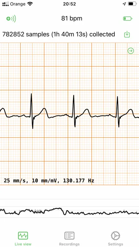 ECG EKG Viewer for Polar H10 screenshot 1 of 3