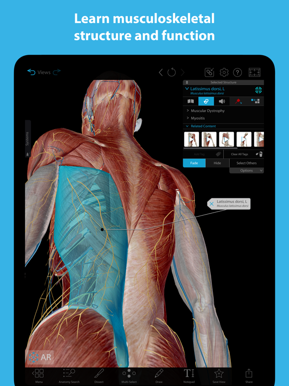 Screenshot #1 for Muscles & Kinesiology