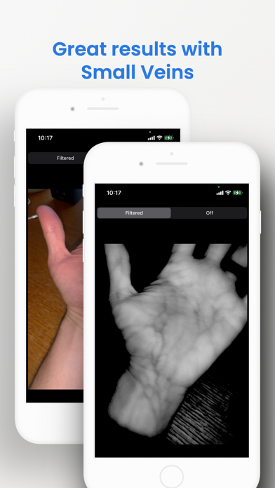 VeinSeek Proのおすすめ画像4