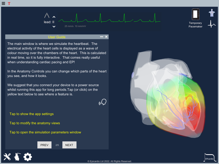 Epicardio Heart Simulator