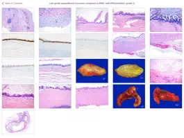 Game screenshot Appendiceal Pathology apk