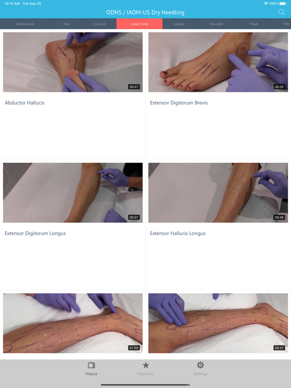 Dry Needling Clinic Companion iPad app afbeelding 2