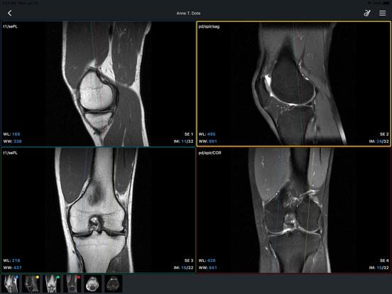 IDV - IMAIOS DICOM Viewerのおすすめ画像3