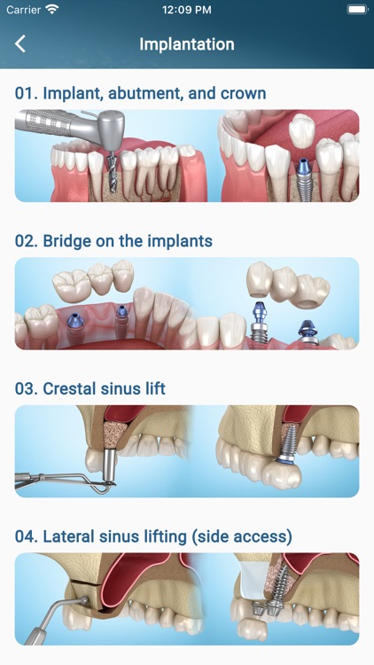 Dental 3D Illustrations