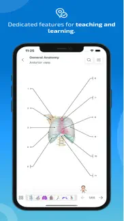 How to cancel & delete imaios e-anatomy 4