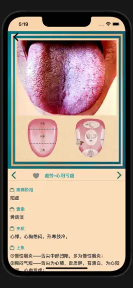 Game screenshot 中医舌诊宝典 apk