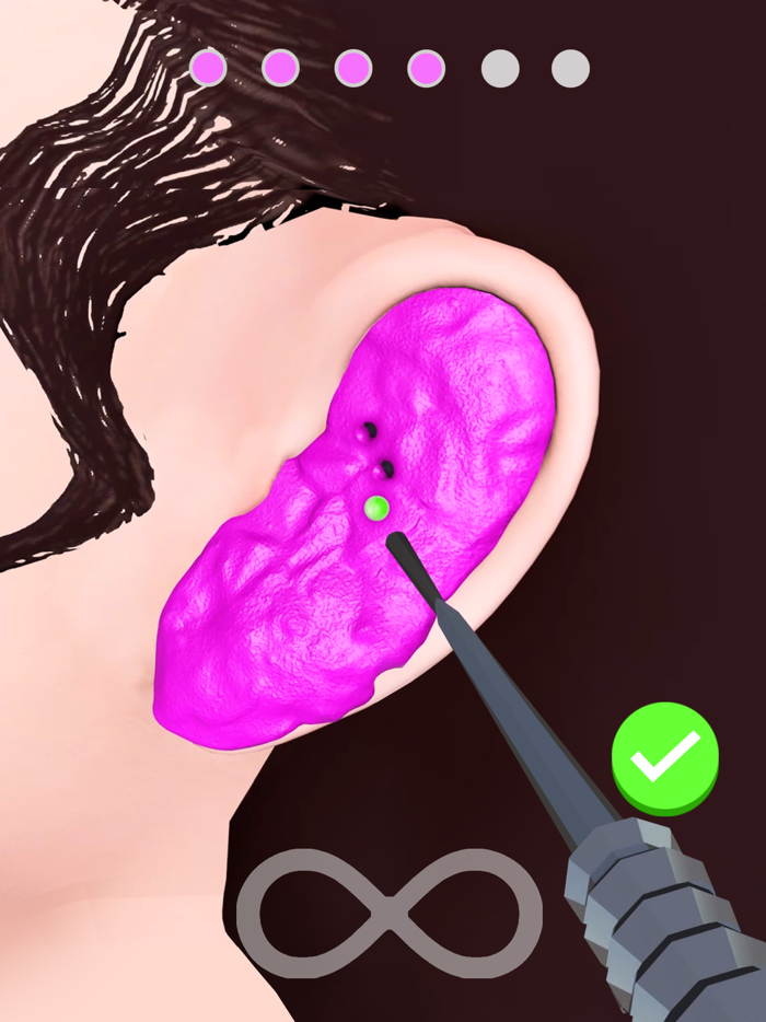 Earwax Removal