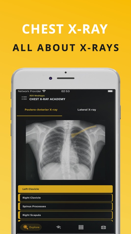 Chest X-ray Academy: Learn CXR - 1.0 - (iOS)