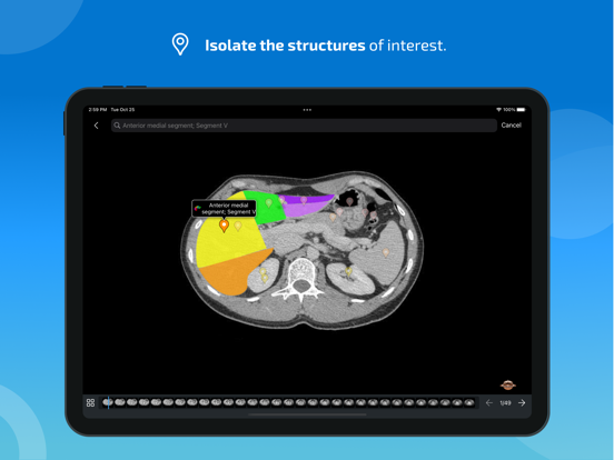 IMAIOS e-Anatomy iPad app afbeelding 4