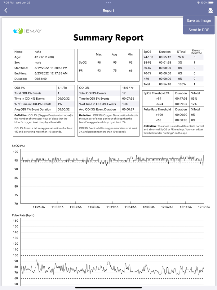 EMAY Bluetooth Pulse Oximeter