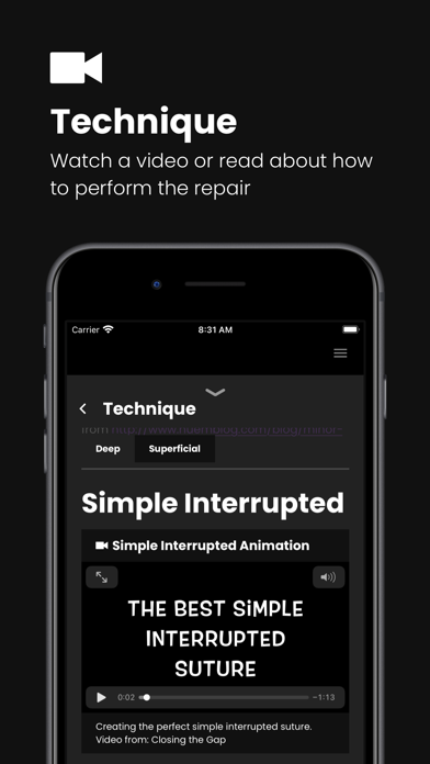 Suture: Laceration Repair App Screenshot