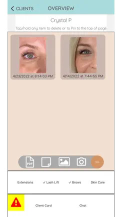EYE2EYE Pro iPhone image 3