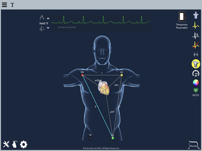Epicardio Heart Simulator