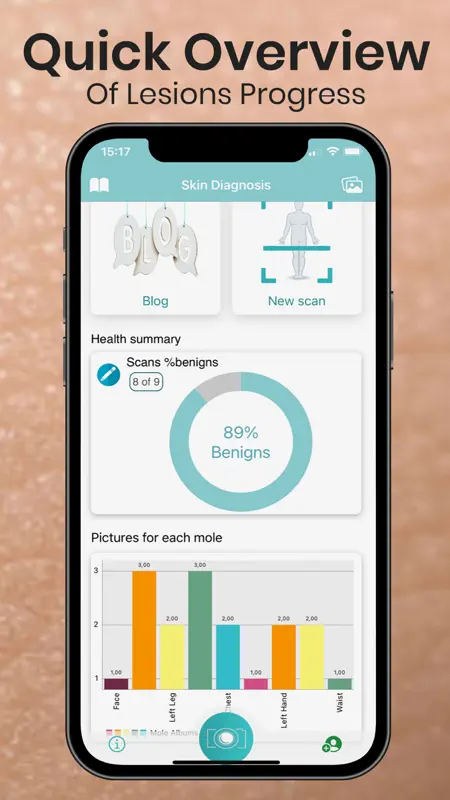 Mole Checker Skin Dermatology screenshot 7 of 10