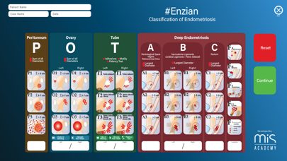 Enzian Classification | MIS Screenshot