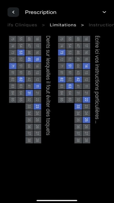 Aligneurs Francais Screenshot