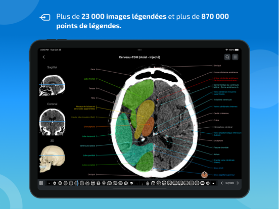 Screenshot #5 pour IMAIOS e-Anatomy