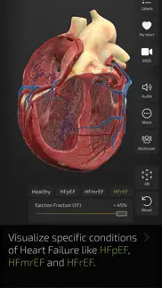 insight heart iphone screenshot 4