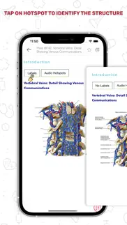 human anatomy atlas + iphone screenshot 3