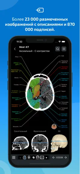 Game screenshot IMAIOS e-Anatomy apk