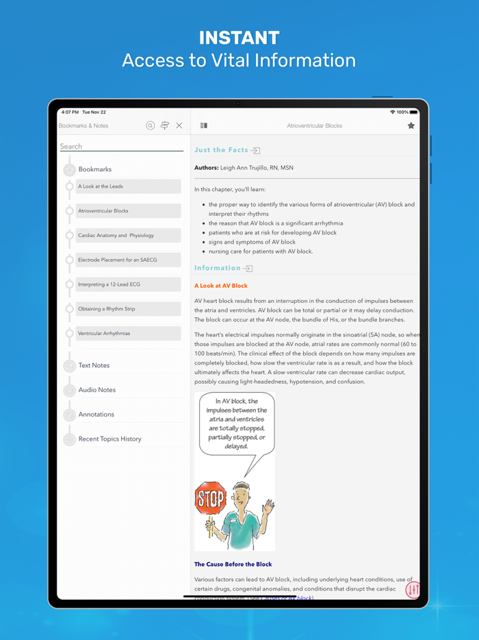 ECG Interpretation MIE