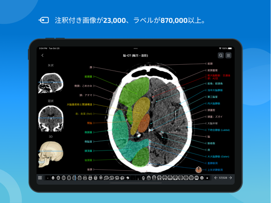 IMAIOS e-Anatomyのおすすめ画像2
