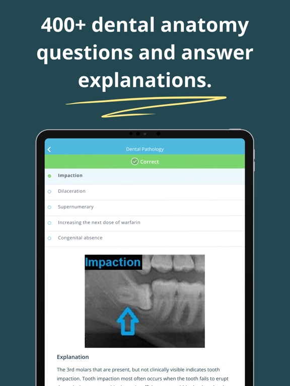 Screenshot #6 pour Dental Anatomy Mastery
