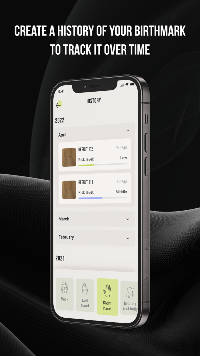 CUBE-Check Ur Birthmark Easily