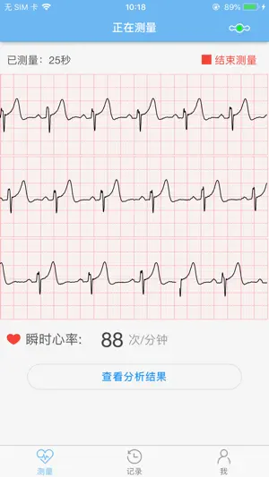 数维康心电 screenshot 3