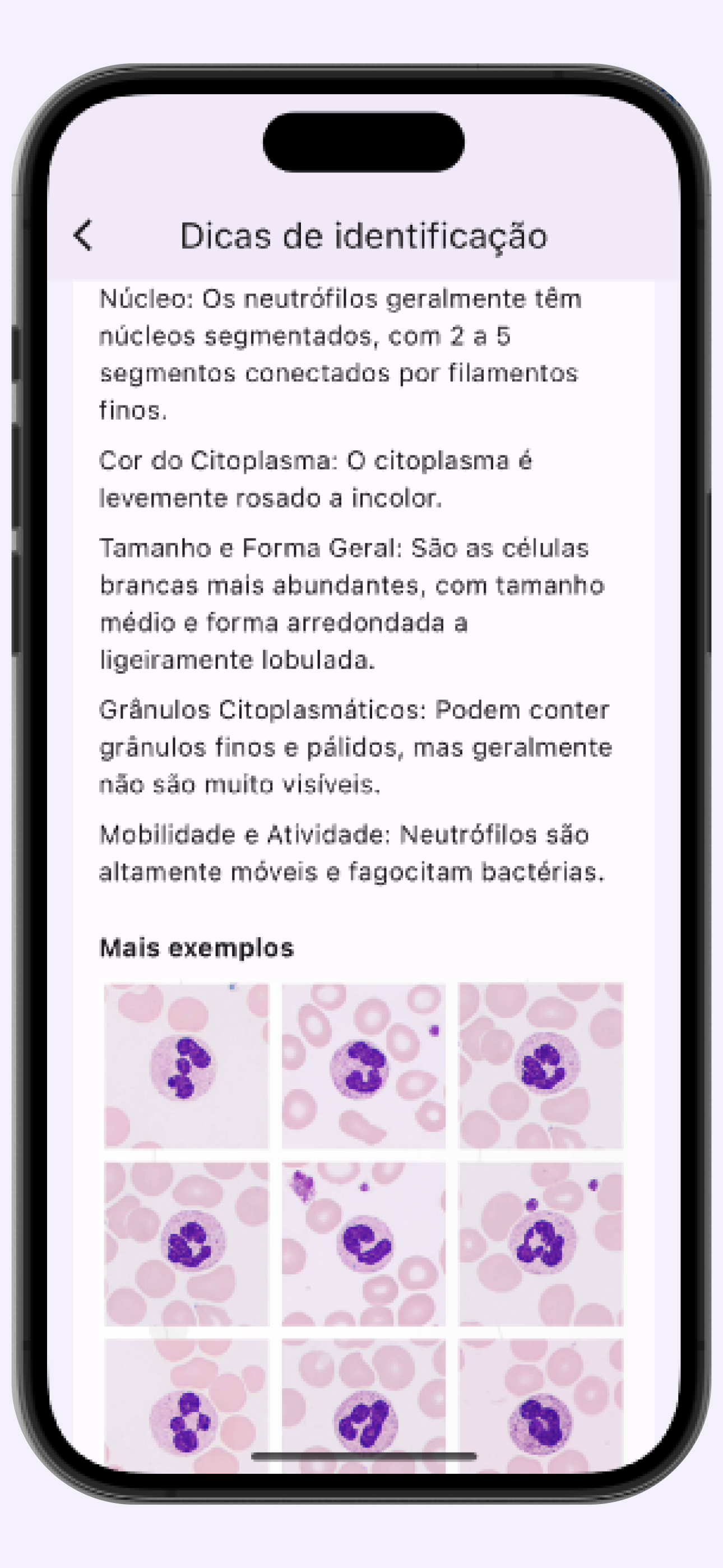 Leucogram | wbc counter
