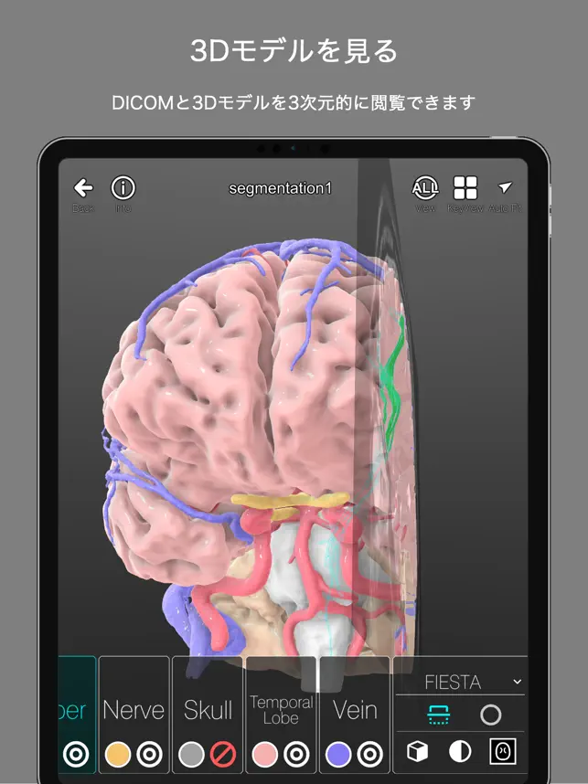 Captura 3 palm : DICOM & 3DModel Viewer iphone