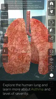 insight lung iphone screenshot 4
