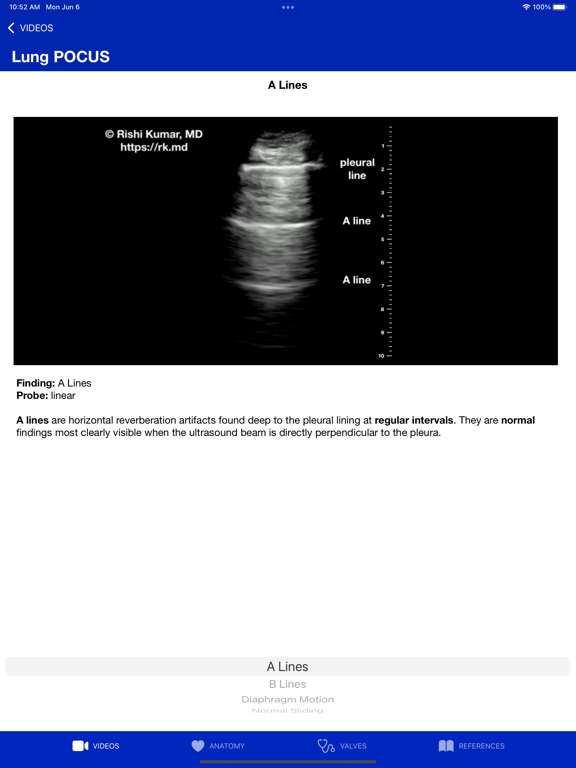 EchoToolsのおすすめ画像6