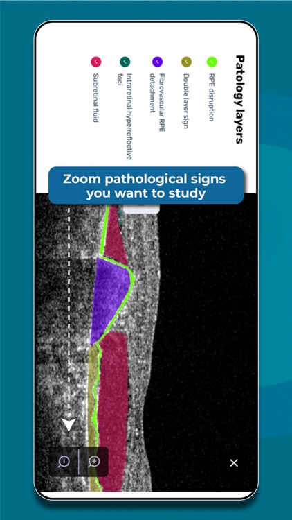 Altris Education OCT screenshot-3